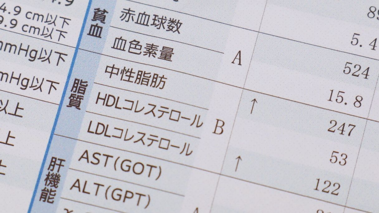 脂質異常症を改善するには?進行した際のリスクについても解説